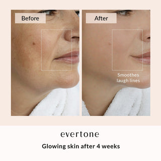 LED FACE & NECK MASK - Evertone Skin