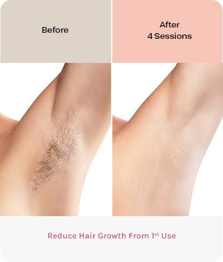 Eversmooth